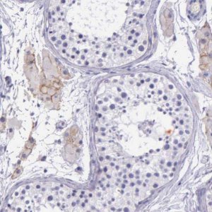 Anti-THSD7A antibody produced in rabbit 