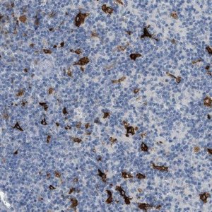 Anti-TIMD4 antibody produced in rabbit 