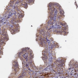 Anti-TLCD1 antibody produced in rabbit 