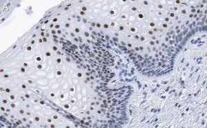Anti-TLE3 Antibody, clone 1D15 ZooMAb� Rabbit Monoclonal 