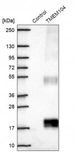 Anti-TMEM104 antibody produced in rabbit 