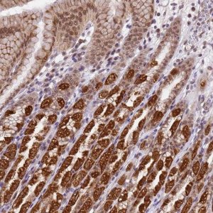 Anti-TMEM104 antibody produced in rabbit 