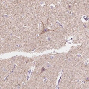 Anti-TMEM130 antibody produced in rabbit HPA012928-100UL