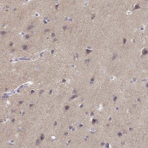 Anti-TMEM145 antibody produced in rabbit 