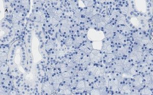 Anti-TMEM16A Antibody, clone 3J18, ZooMAb� Rabbit Monoclonal 