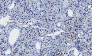 Anti-TMEM16A Antibody, clone 3J18, ZooMAb� Rabbit Monoclonal 
