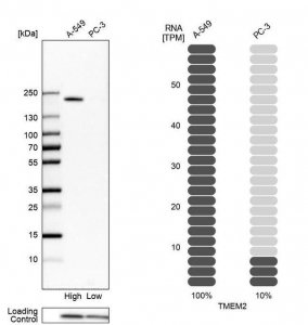 Anti-TMEM2 antibody produced in rabbit 