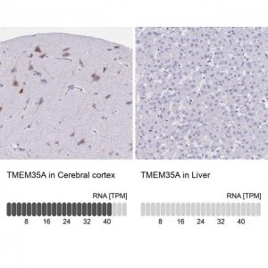Anti-TMEM35A antibody produced in rabbit 