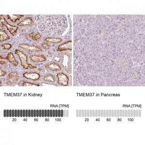 Anti-TMEM37 antibody produced in rabbit 