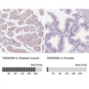 Anti-TMEM38A antibody produced in rabbit HPA050463-100UL