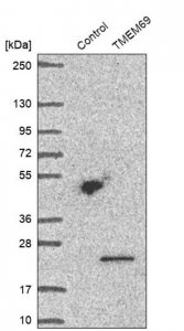 Anti-TMEM69 antibody produced in rabbit HPA026993-100UL