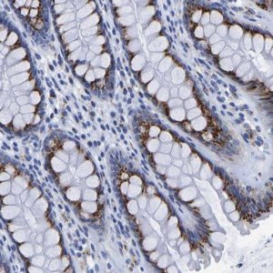 Anti-TMEM87A antibody produced in rabbit 