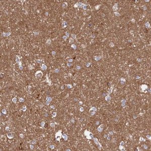 Anti-TMOD2 antibody produced in rabbit 