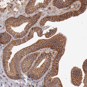 Anti-TMOD3 antibody produced in rabbit HPA001849-100UL