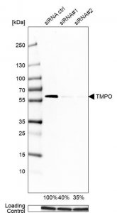 Anti-TMPO antibody produced in rabbit 
