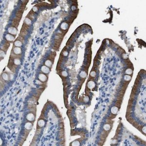 Anti-TMPRSS15 antibody produced in rabbit 