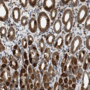 Anti-TMX3 antibody produced in rabbit HPA014157-100UL