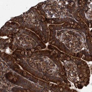 Anti-TNFRSF10B antibody produced in rabbit 
