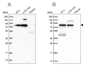 Anti-TNIP1 antibody produced in rabbit 
