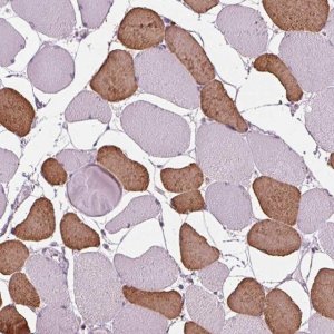 Anti-TNNC2 antibody produced in rabbit 