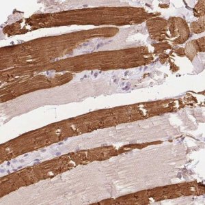 Anti-TNNT3 antibody produced in rabbit 