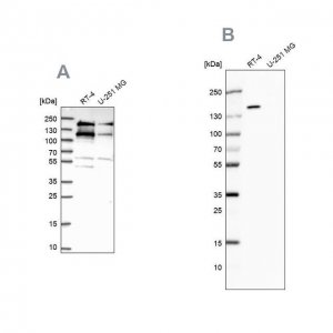 Anti-TOP2B antibody produced in rabbit 