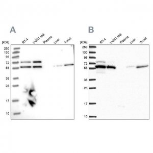 Anti-TOR1AIP1 antibody produced in rabbit 