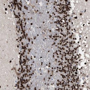 Anti-TP53BP1 antibody produced in rabbit 