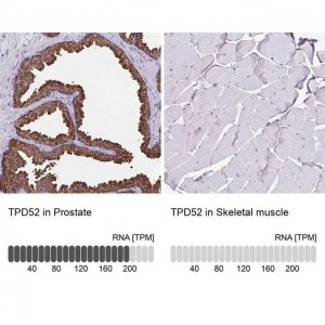 Anti-TPD52 antibody produced in rabbit HPA062167-100UL