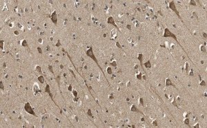 Anti-TPH-1 Antibody, clone 3J7 ZooMAb� Rabbit Monoclonal 