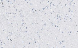 Anti-TPH-1 Antibody, clone 3J7 ZooMAb� Rabbit Monoclonal 