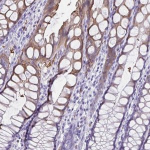 Anti-TPSG1 antibody produced in rabbit 