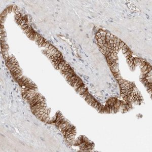 Anti-TRAPPC3 antibody produced in rabbit HPA028408-100UL