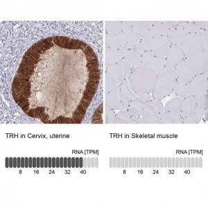 Anti-TRH antibody produced in rabbit 