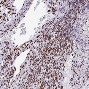 Anti-TRIM28 antibody produced in rabbit 