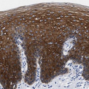Anti-TRIM29 antibody produced in rabbit 