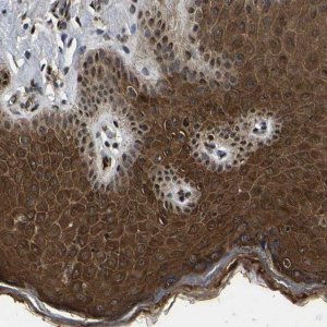 Anti-TRIM35 antibody produced in rabbit 