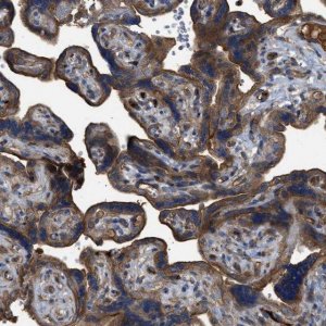 Anti-TRIOBP antibody produced in rabbit 