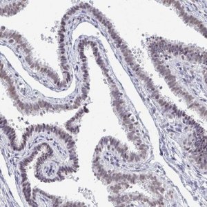 Anti-TRIP12 antibody produced in rabbit 