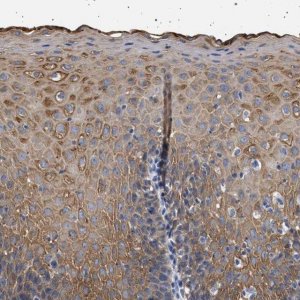 Anti-TRMT10B antibody produced in rabbit 