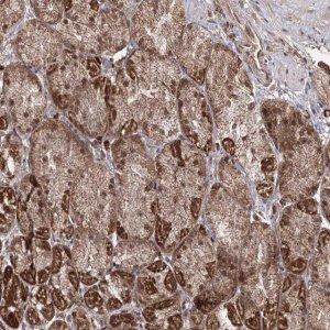 Anti-TRNT1 antibody produced in rabbit 
