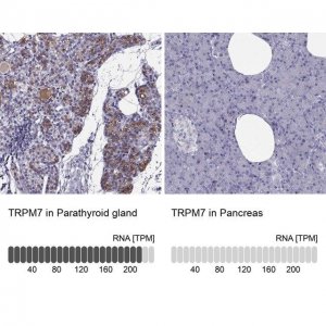 Anti-TRPM7 antibody produced in rabbit 
