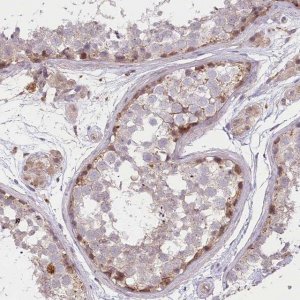 Anti-TRUB1 antibody produced in rabbit 