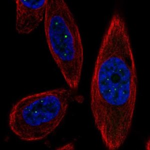 Anti-TSACC antibody produced in rabbit 