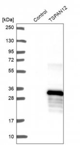 Anti-TSPAN12 antibody produced in rabbit HPA058244-100UL