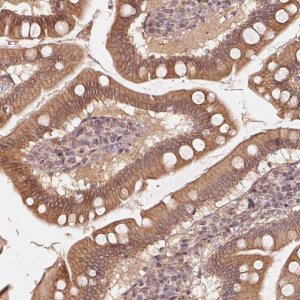 Anti-TSPAN12 antibody produced in rabbit HPA058244-100UL