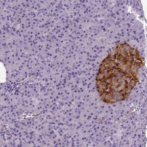 Anti-TSPAN7 antibody produced in rabbit 