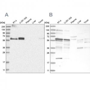 Anti-TSPYL1 antibody produced in rabbit 