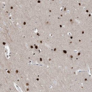 Anti-TSPYL1 antibody produced in rabbit 