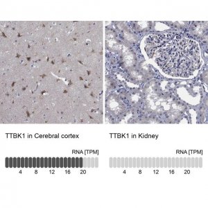 Anti-TTBK1 antibody produced in rabbit 
